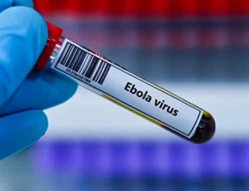 Moderna kicks off Phase I Ebola trial as Africa readies itself for research