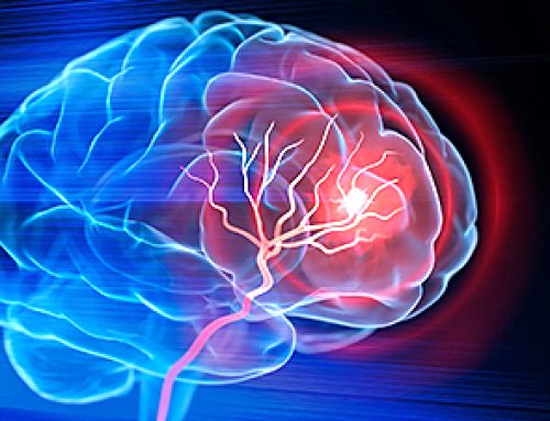 New injectable treatment helps the brain rebuild after stroke